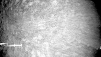 Weather camera view of White Plains Regional Park.