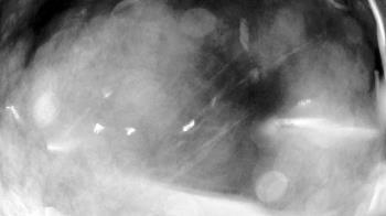 Weather camera view of North Putnam MS.